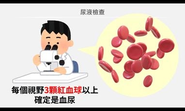 血尿